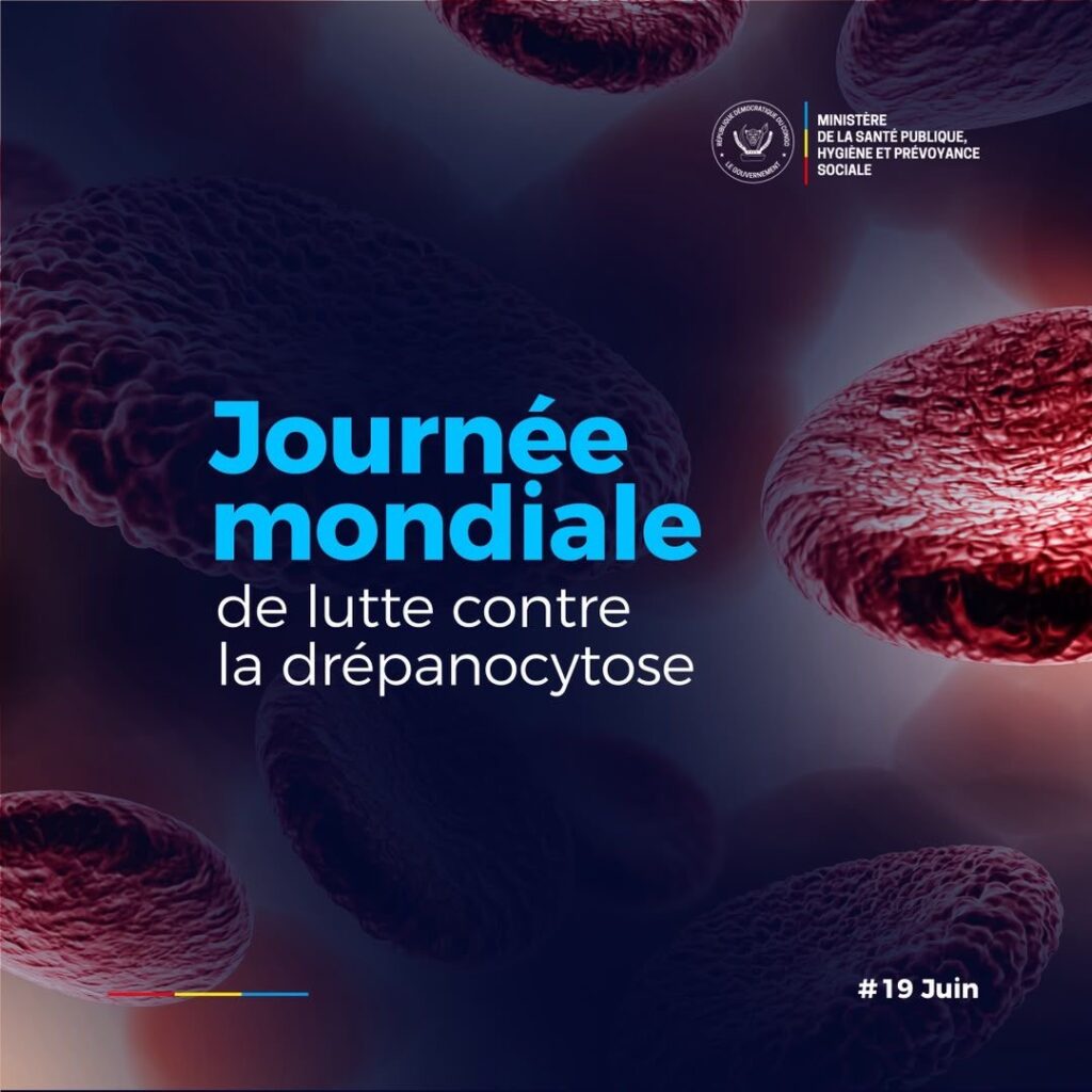 Journée mondiale de la drépanocytose : sur 7,74 millions de malades dans le monde, plus de 73 % vivent en Afrique