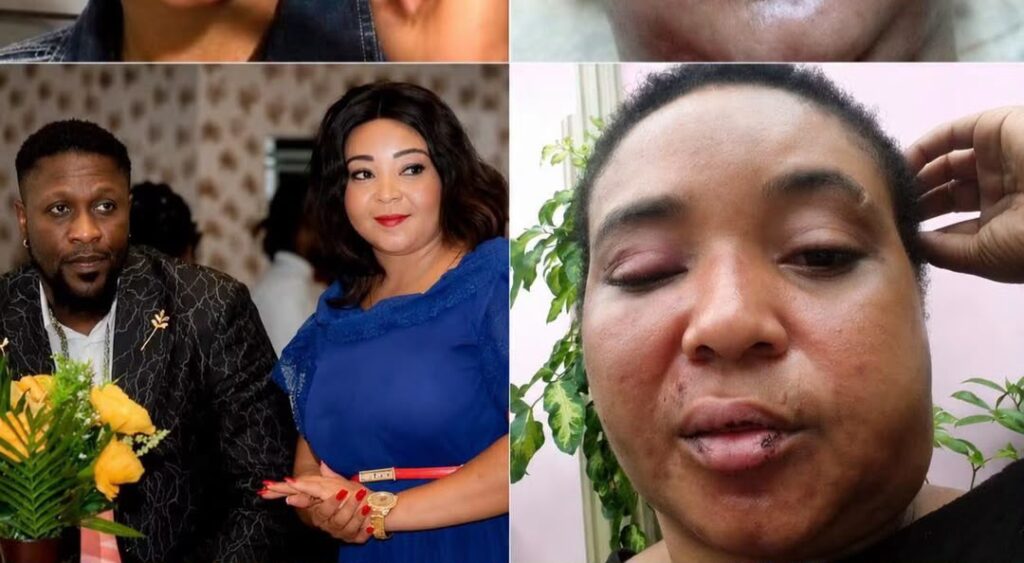 RDC : Linda Mondele affirme être victime de violences conjugales et appelle à la justice